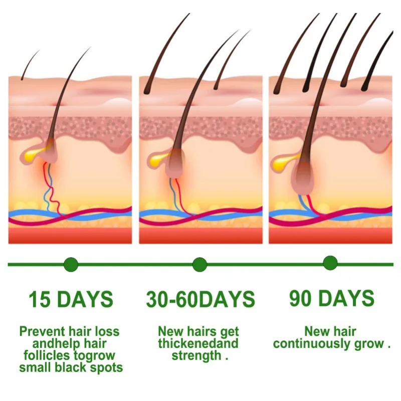 Saç Büyüme Serumu Hızlı Büyüye - Hair Care Frizzy Hair incelemesi ve fiyatı