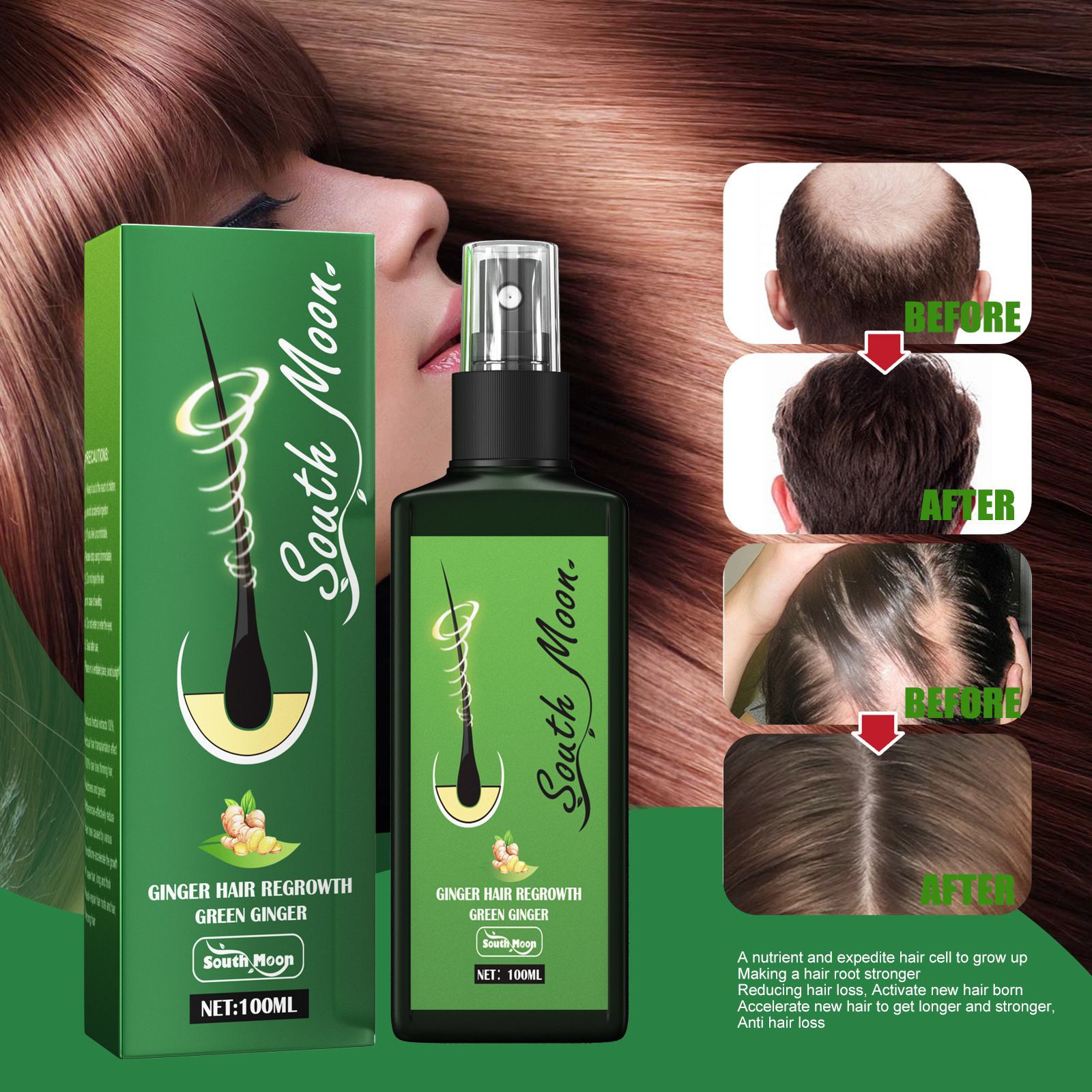 South Moon Zencefil Saç Uzatma - Hair Care Frizzy Hair incelemesi ve fiyatı