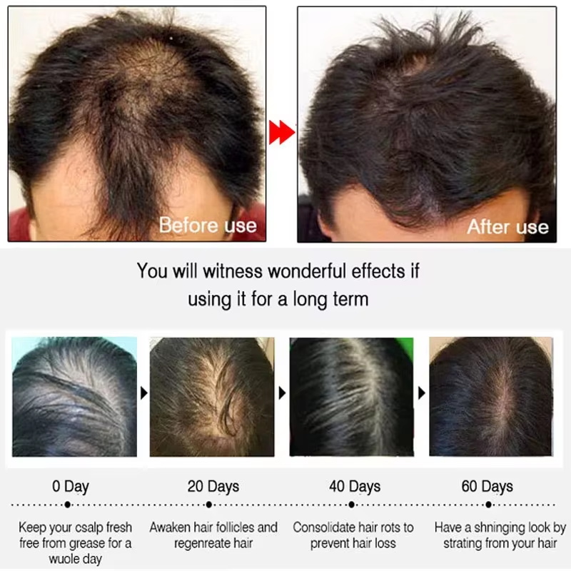 Hızlı Zencefilli Saç Uzatma Sp - Hair Care Frizzy Hair incelemesi ve fiyatı